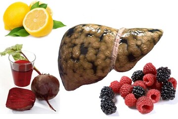 نسخه طب سنتی برای کبد چرب - خبرآنلاین