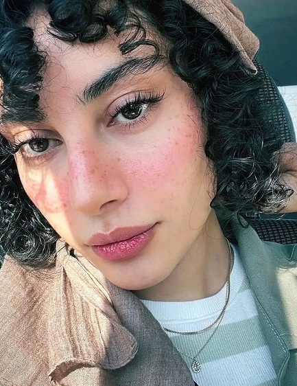 ترلان پروانه با چهره ای جدید ظاهر شد+ عکس