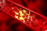 گیاهان دارویی، دشمن طبیعی چربی خون بالا