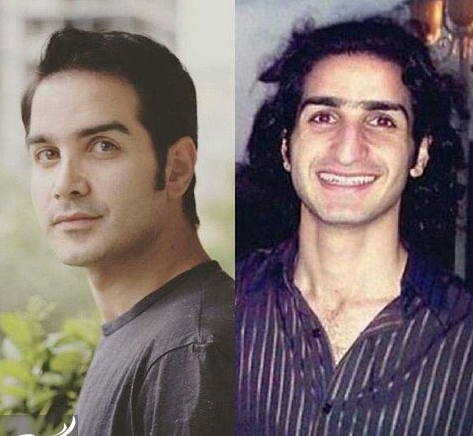 عکسی از محسن یگانه قبل از عمل بینی+عکس