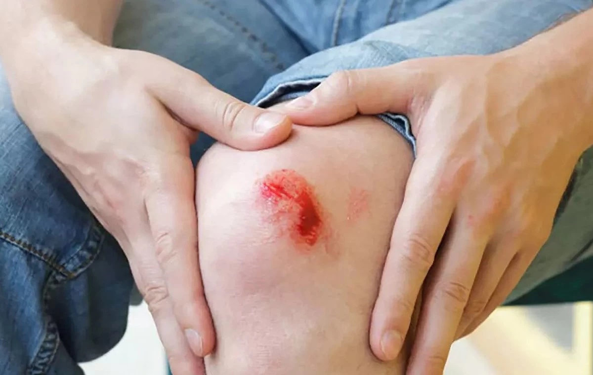 دلایل نکندن زخم خشک نشده