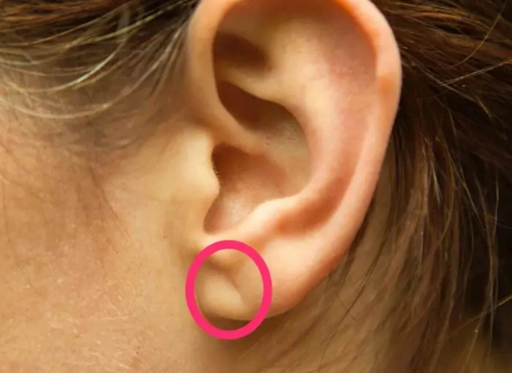 تاریخچه کشف ارتباط چین لاله گوش با بیماری ها