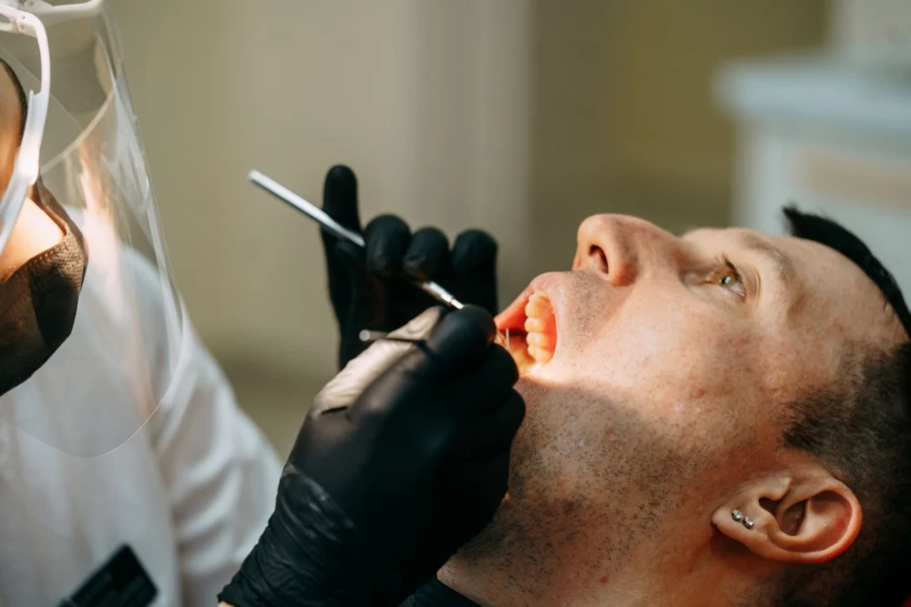 سیاه شدن لثه بعد از ایمپلنت