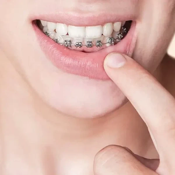 5 علت درد لثه و فک پایین که باید جدی بگیرید!