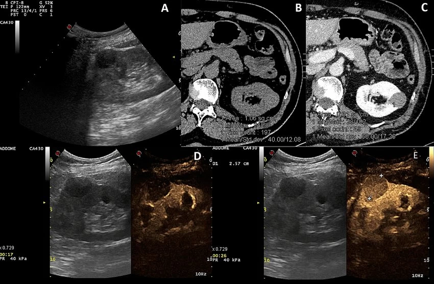 تفاوت رادیولوژی و سونوگرافی در دقت تشخیص و جزییات تصویر