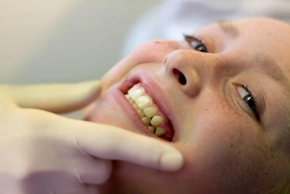 درمان سیاه شدن لثه بعد از ایمپلنت