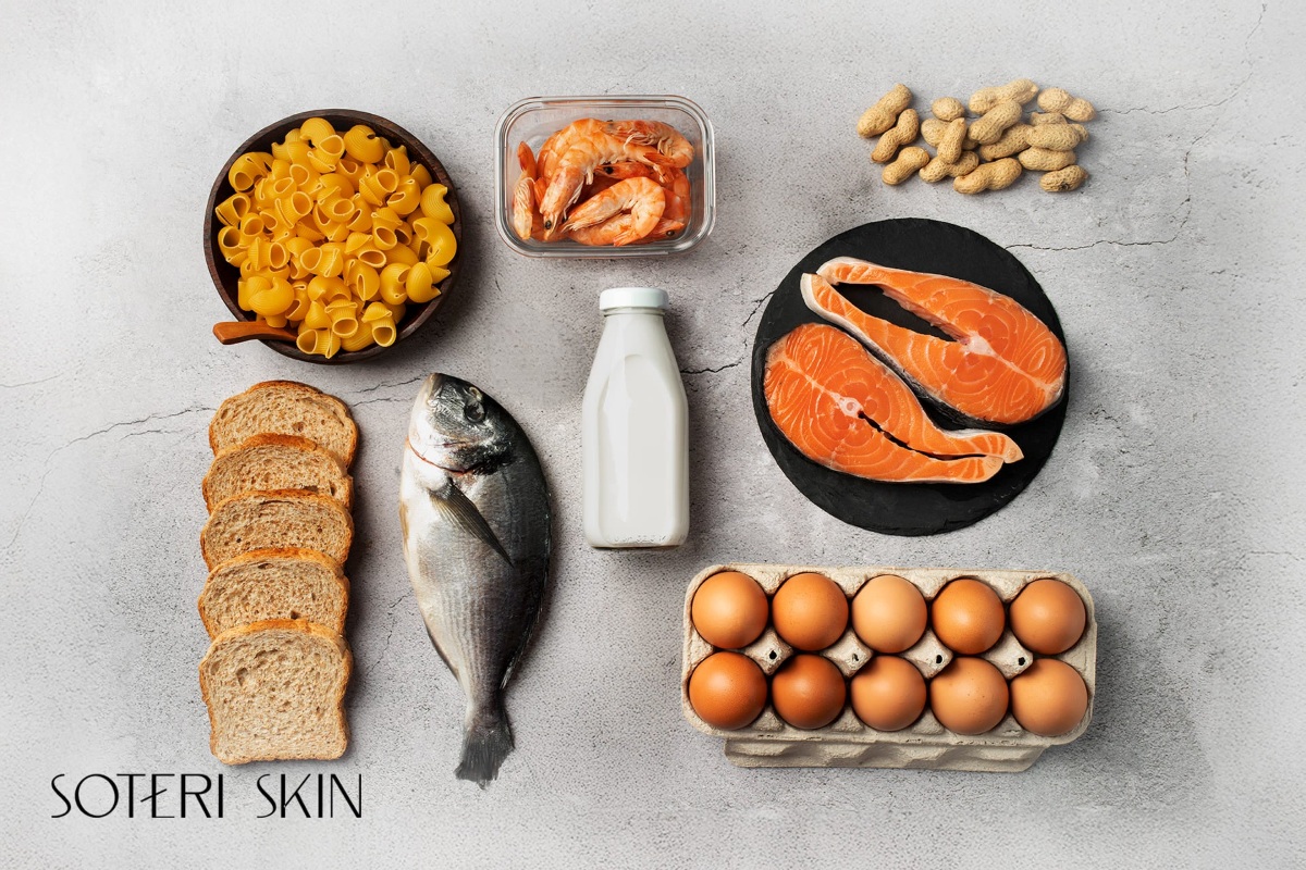 رژیم غذایی مناسب برای اگزما-6