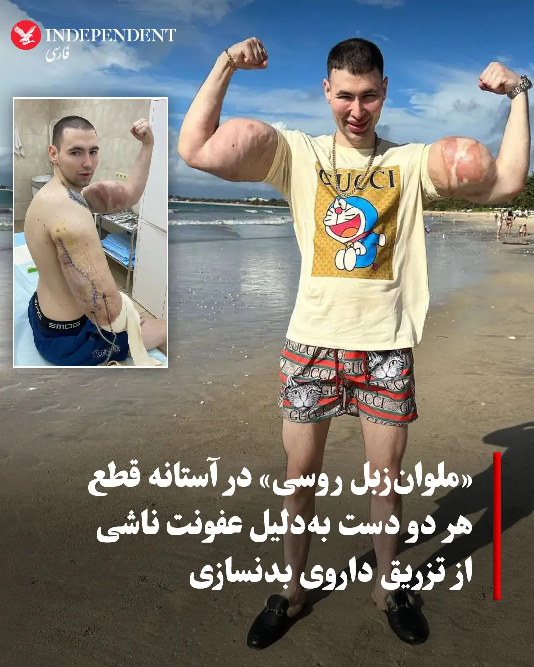 IMG_20251125_085322_228