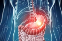 اثر ریفلاکس معده بر بروز اختلالات خواب