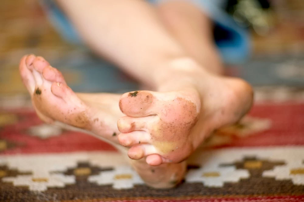 تیرگی حنا در کف پا