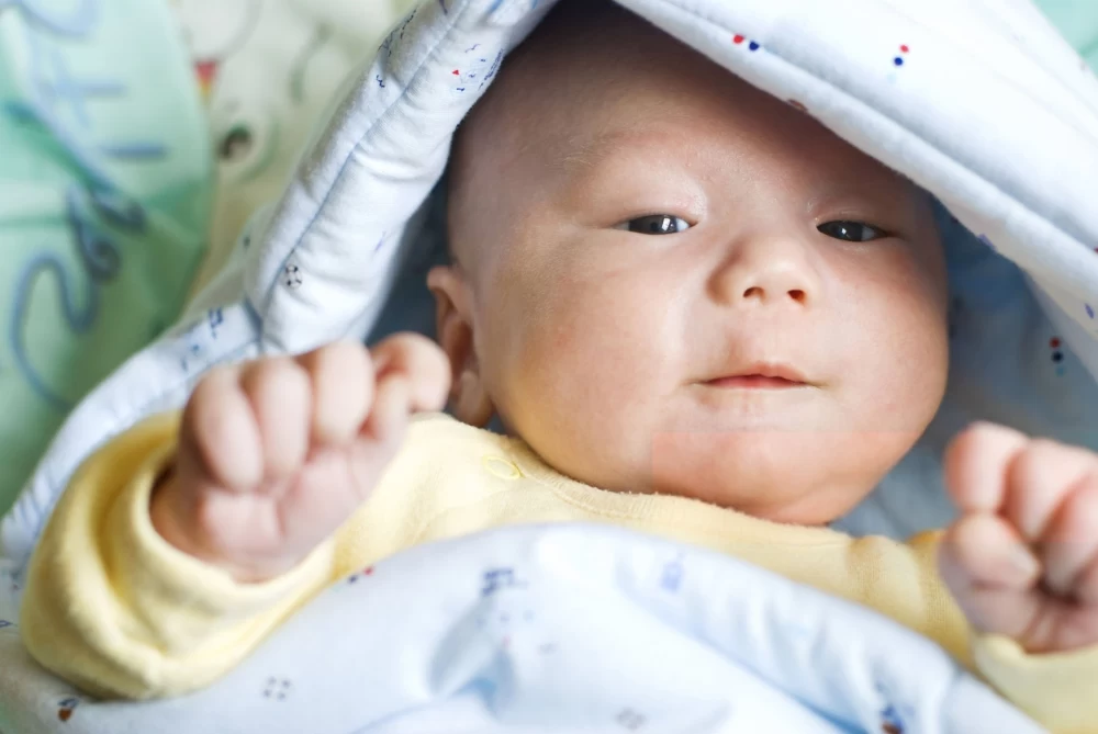 زردی چشمان نوزاد