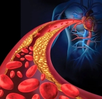 این 7 علامت نشان دهنده لخته شدن خون است