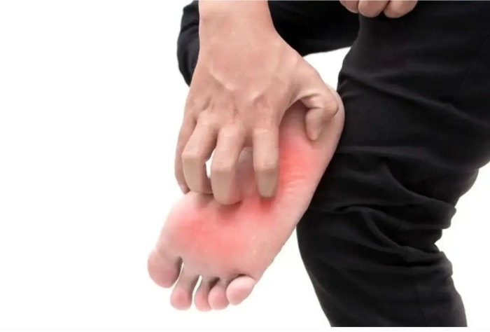 خارش کف پا را جدی بگیریم؟ از علت‌های ساده تا نشانه‌های خطرناک