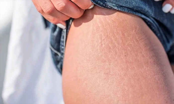 پوست شما چه رازی از سلامت‌تان فاش می‌کند؟ علائمی که می‌توانند خطرناک باشند