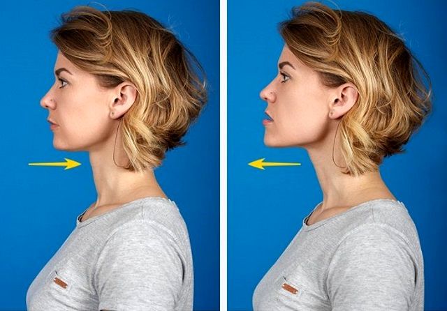 غبغب چیست و چطور آن را از بین ببریم؟ دلایل ایجاد غبغب