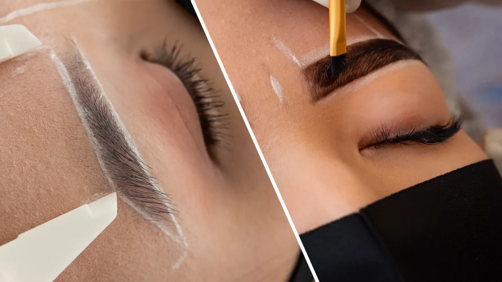 فرق میکروکاشت با کاشت ابرو